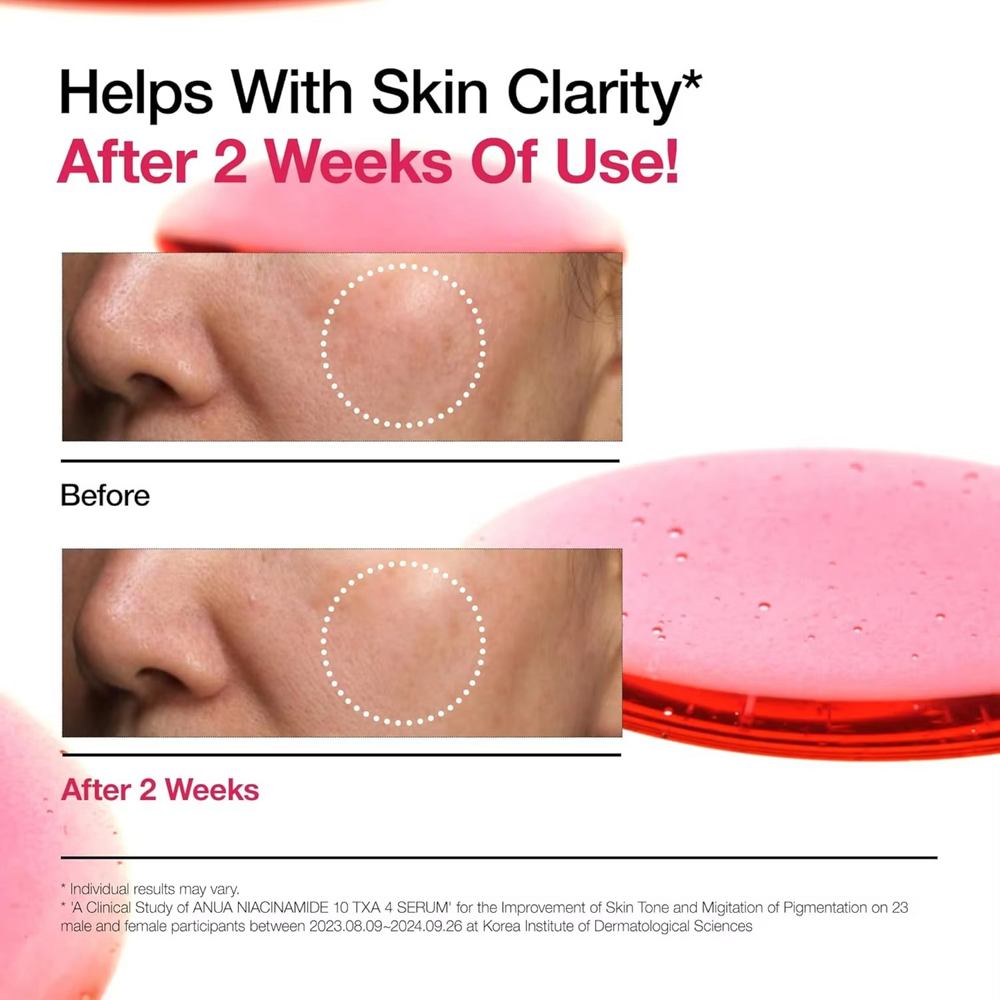 ANUA TXA 10% Niacinamide 4% Serum Hyaluronic Acid Vitamin B12 Purifying and Brightening