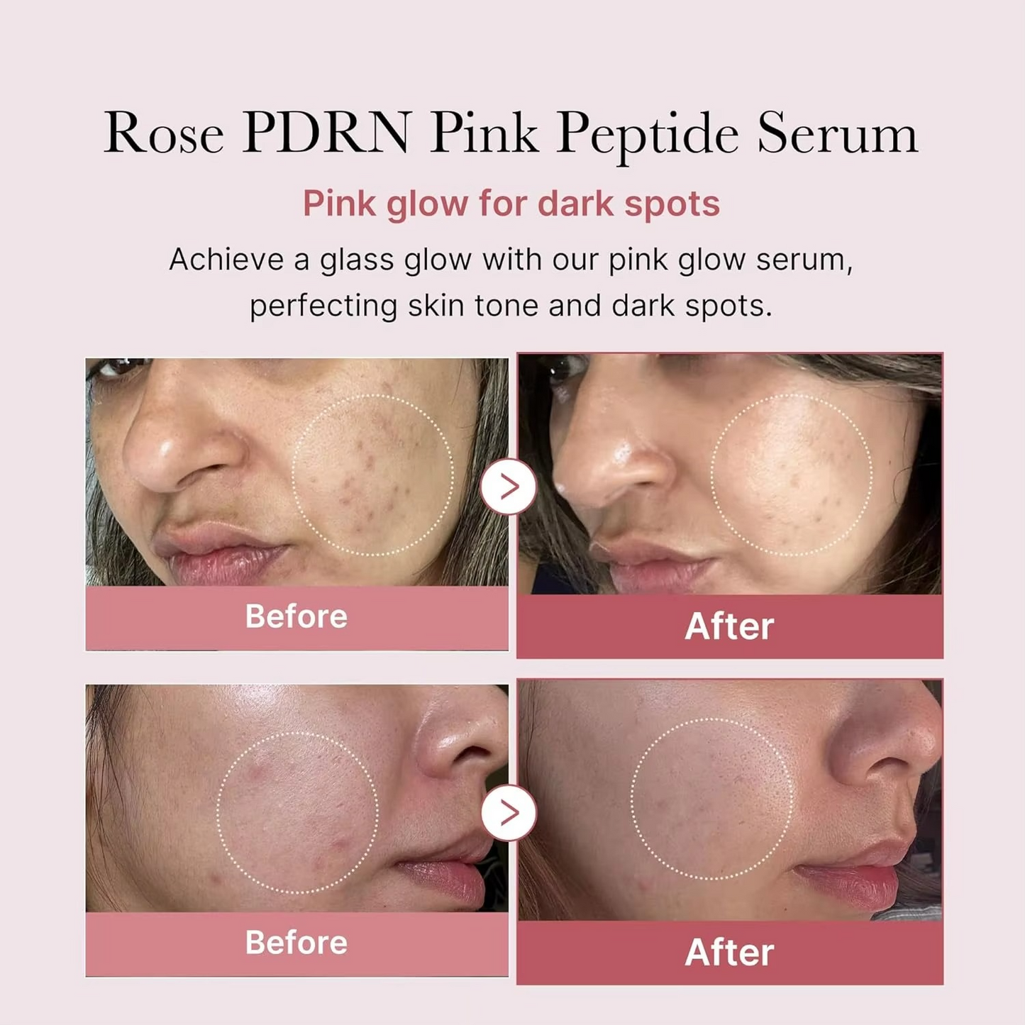 Medicube PDRN Pink Peptide Serum Korea Vegan Skincare Hydrating Moisturizing Firming Even Skin Tone