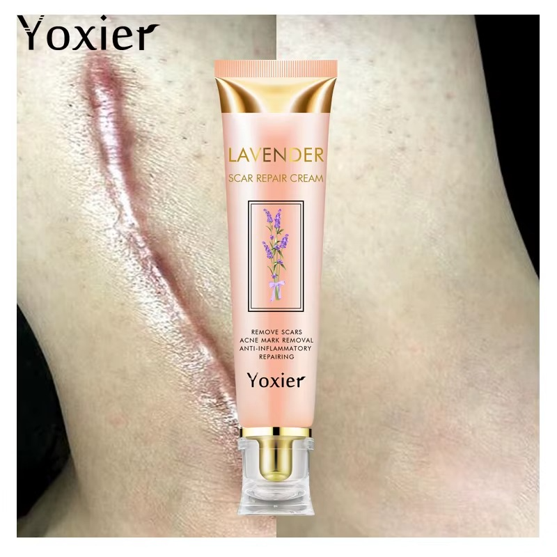 Yoxier Lavender Scar Repair Cream For all Scar Types, Stretchmarks Acne Scars, CS scars, Burns etc