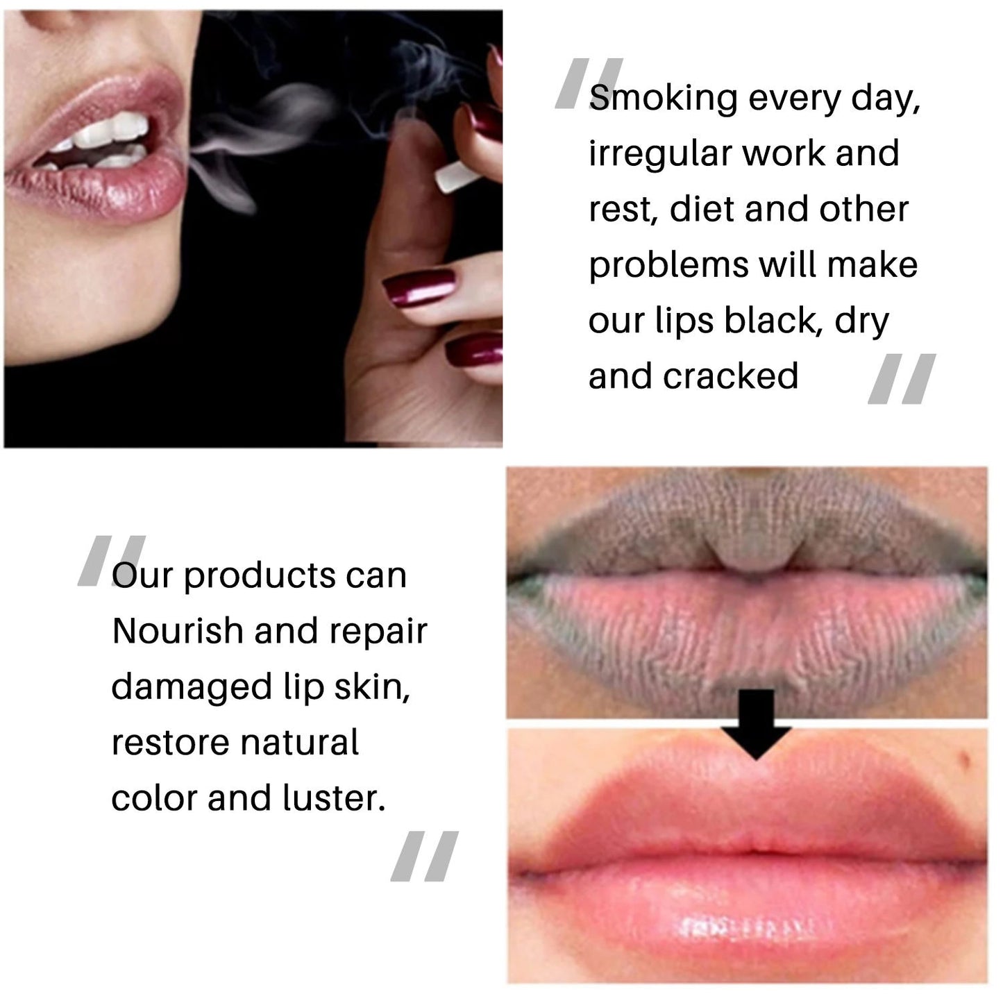 Moisturizing Lip Brightening Balm Cream for Dark Lips with free Lip Plumper