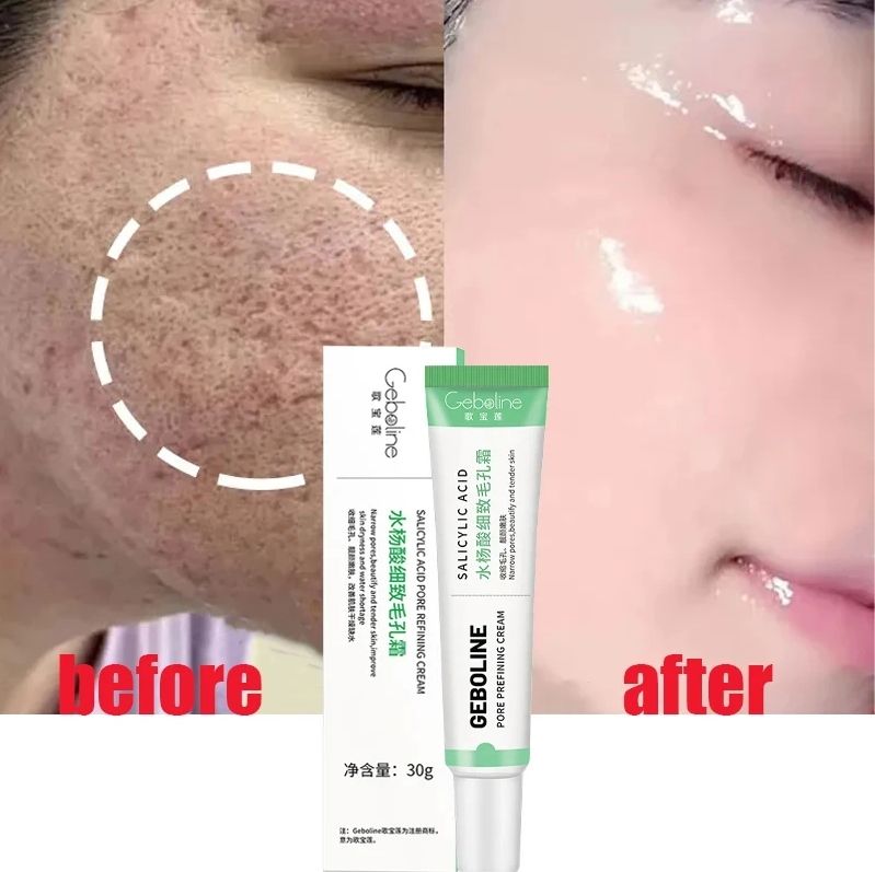 Salicylic Acid Pore Refining Cream, Smoothen Skin Tighten Face and Eliminate Large Pores