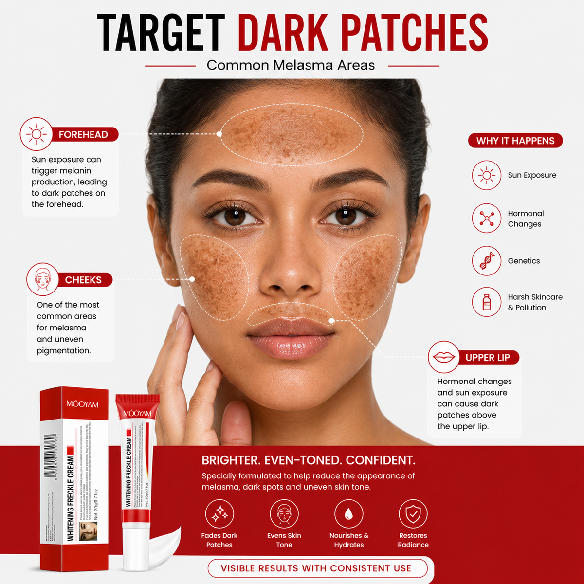Mooyam Melasma, Freckles and Dark spot Removal Cream