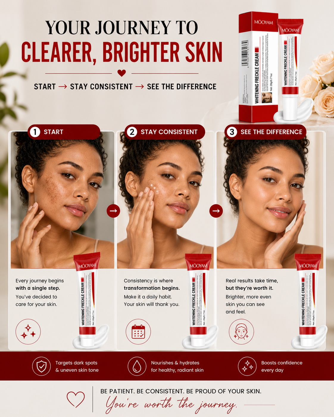 Mooyam Melasma, Freckles and Dark spot Removal Cream