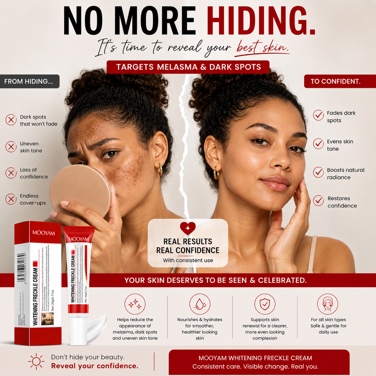 Mooyam Melasma, Freckles and Dark spot Removal Cream
