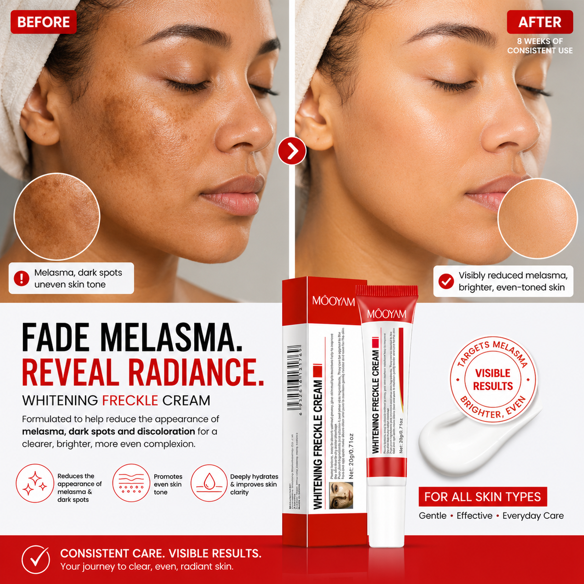 Mooyam Melasma, Freckles and Dark spot Removal Cream
