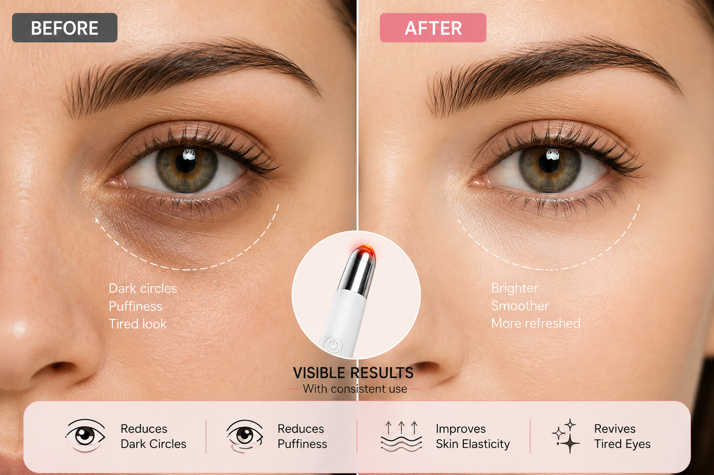 Led Micro Current Electric, Vibration Eye Rejuvenation Device - Eyebags, Dark Circles & Wrinkles