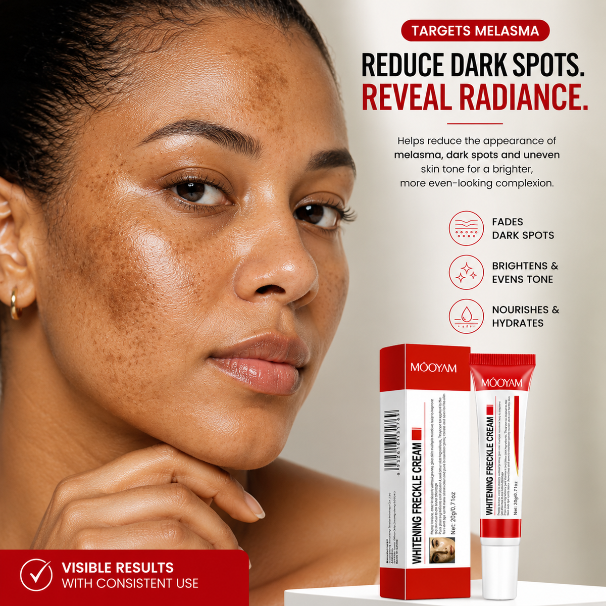 Mooyam Melasma, Freckles and Dark spot Removal Cream
