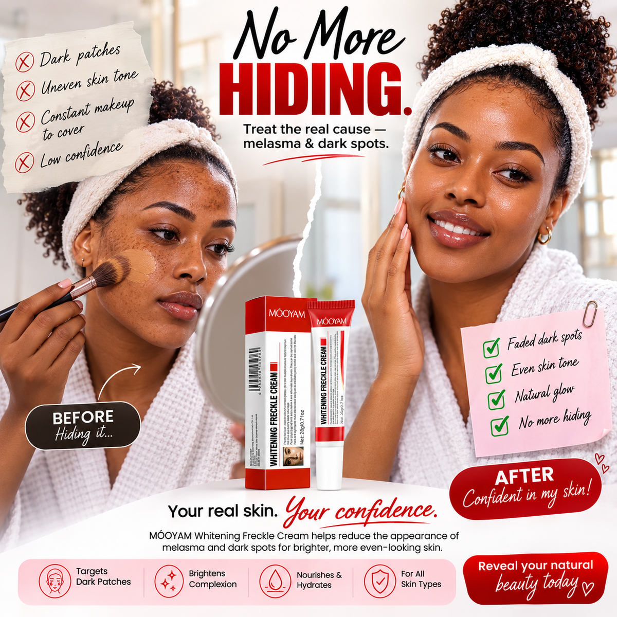Mooyam Melasma, Freckles and Dark spot Removal Cream