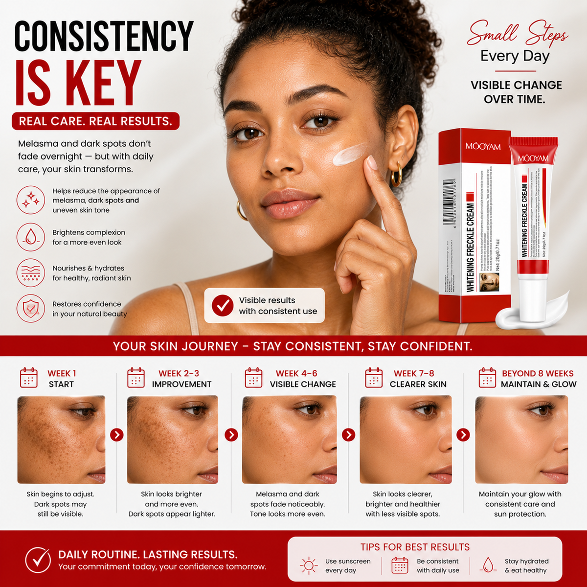 Mooyam Melasma, Freckles and Dark spot Removal Cream